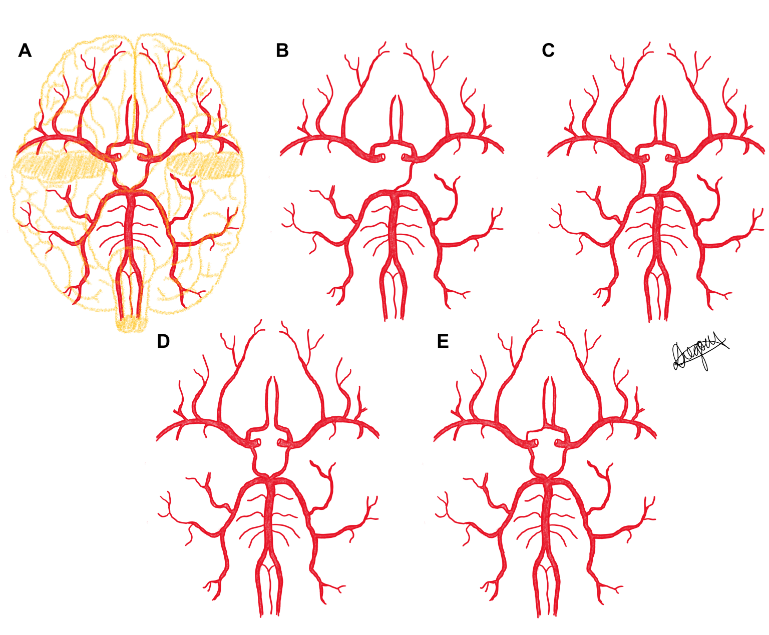 Cardiovascular Case Studies Anatomical Variation An Australian and