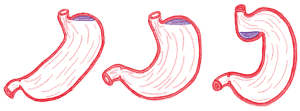 Examples of three common stomach morphology variations