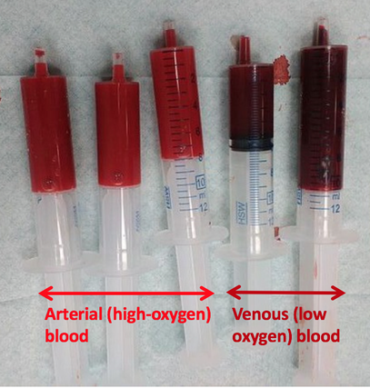 What Color is Your Blood Without Oxygen?