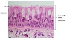 Chapter 9: THE RESPIRATORY SYSTEM – Anatomy & Physiology