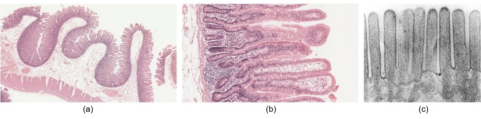 Chapter 15: DIGESTIVE SYSTEM – Human Anatomy (MASTER)