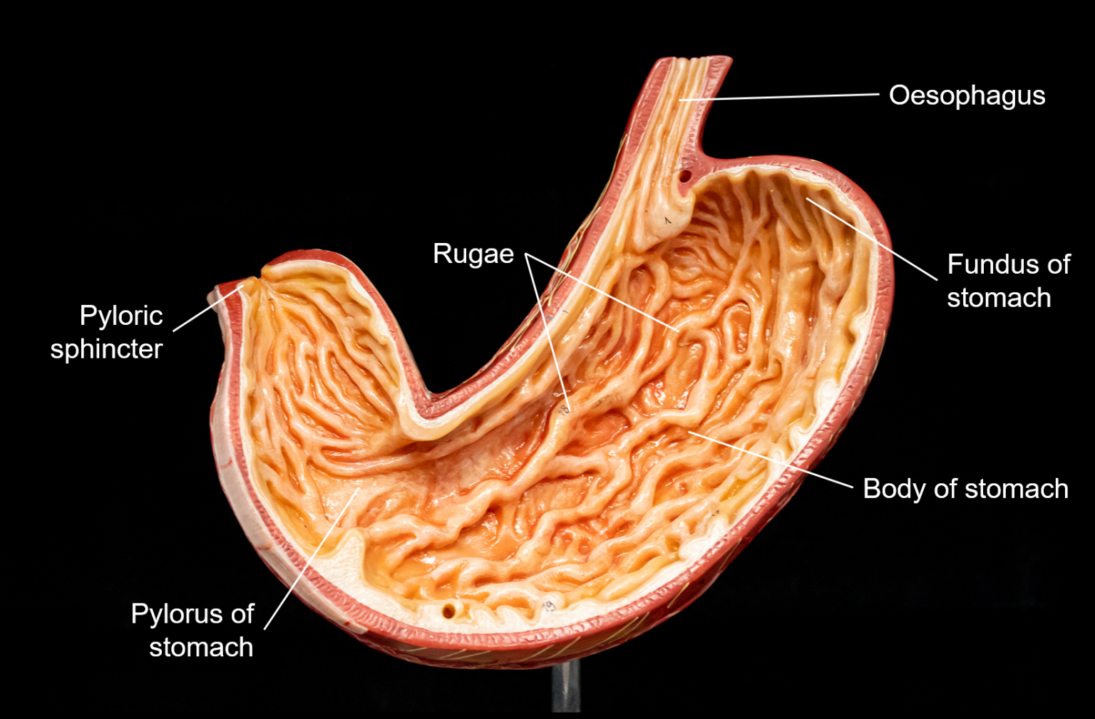 Chapter 15: DIGESTIVE SYSTEM – Human Anatomy (MASTER)