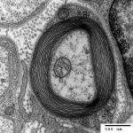 Chapter 11: NERVOUS TISSUE – Human Anatomy (MASTER)